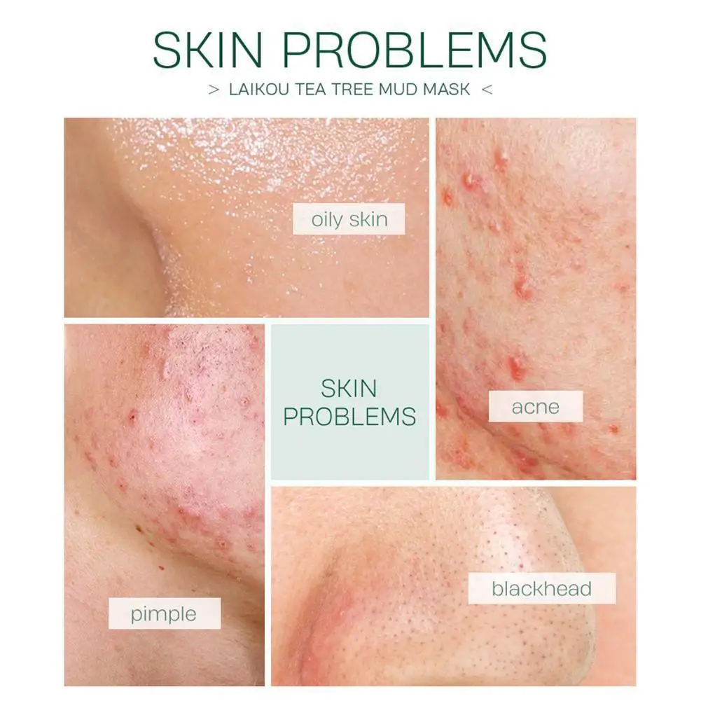 

1pcs Matcha Sleeping Face Moisturizing Acne Treatment Pores Shrink Care Cream Night Oil-control Skin D7z9