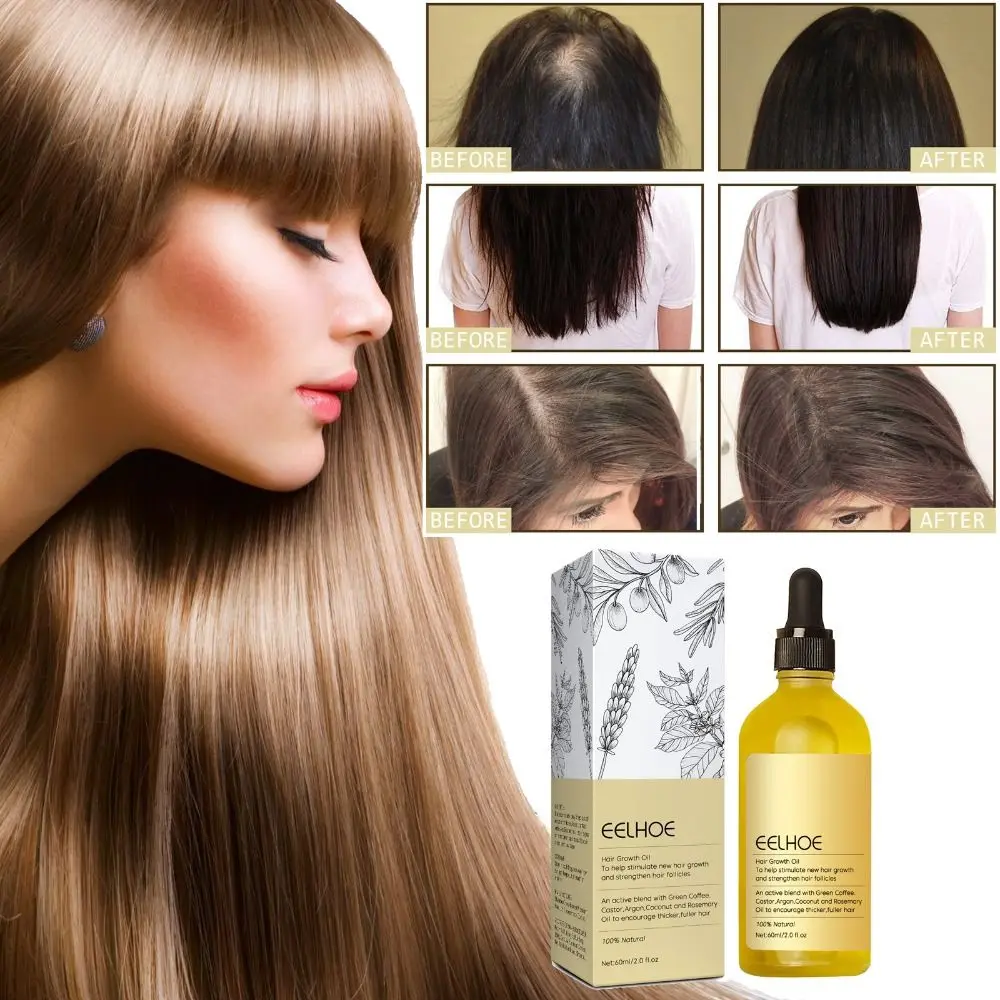 New And Efficient Anti Hair Loss Nourishing Essential Oil For Natural Hair Growth Dense Repair Damaged Hair Moisturizing