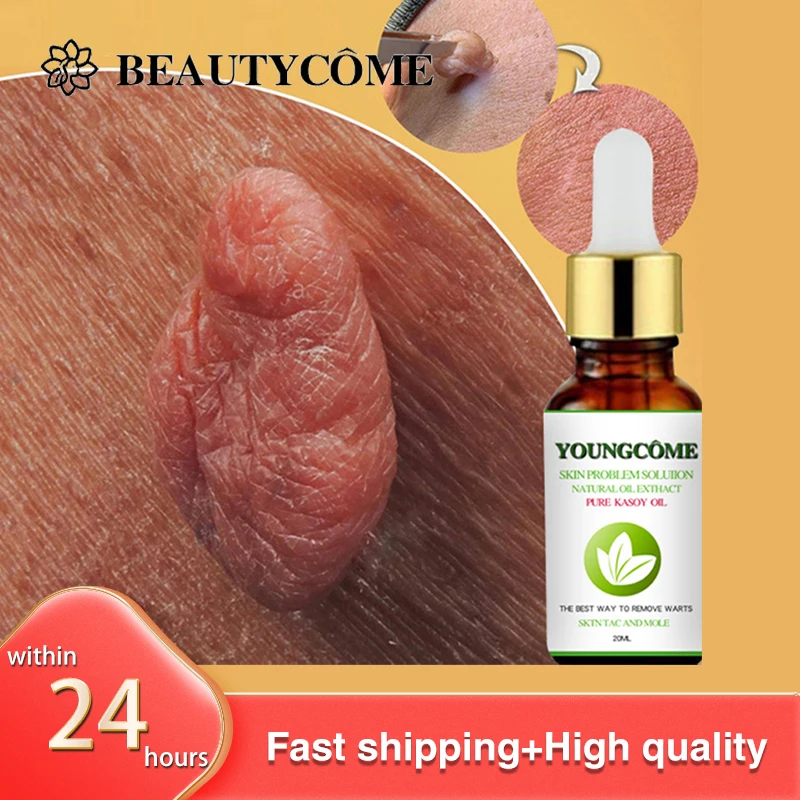 

Organic Tags Solutions Serum Painless Mole Skin Dark Spot Remover Serum Freckle Face Wart Tag Removal Essential Oil 30ml 60ml