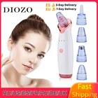 Устройство для удаления черных точек DIOZO, средство для ухода за кожей лица, прибор для удаления прыщей и акне, вакуумный очиститель пор, инструмент для красоты