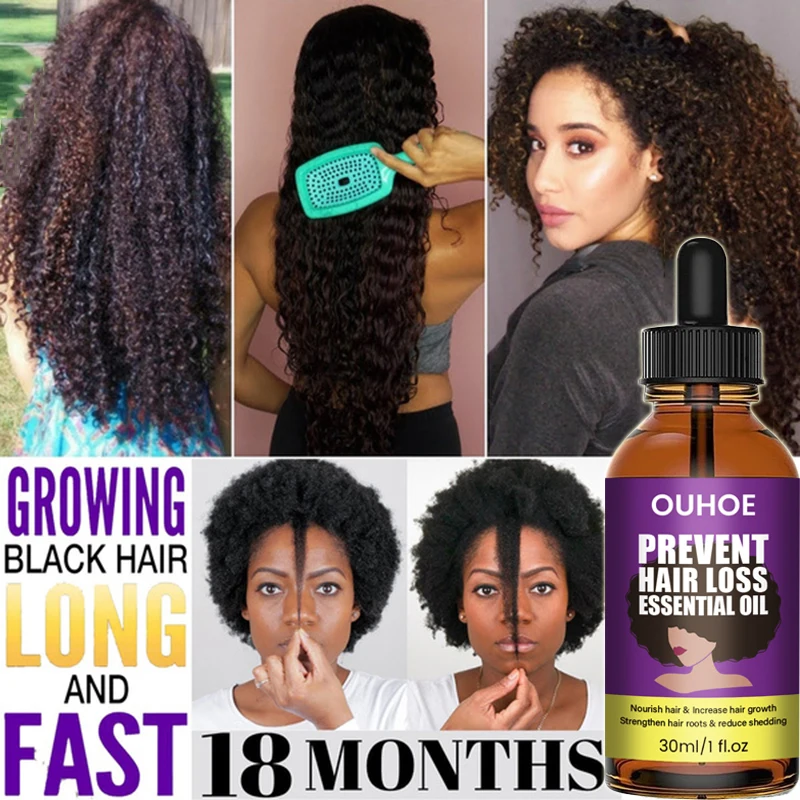 

Эфирные масла для роста волос против Alopecia, эссенция для черных женщин, сыворотка против выпадения волос для истончения и утолщения волос