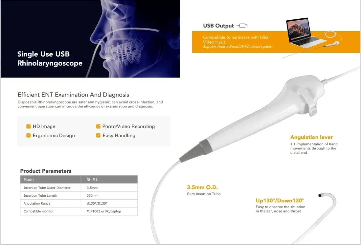 Фото 2025ENT 3,5 мм HD Rinolaringoscópio Portátil Baixo Preço Endoscopia Flexível Para Rhinolaryngoscope №3