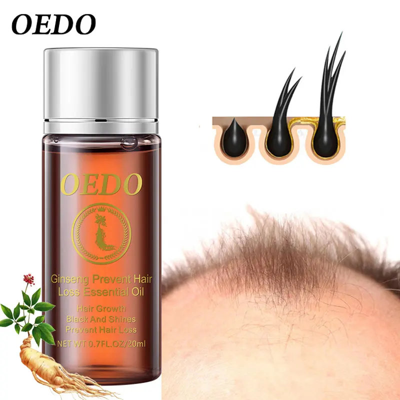 Ginseng Hair Growth Oil Prevent Hair Loss Essential Oils Repair Damaged Hair Strengthen Hair Roots Accelerate Hair Growth 20ml