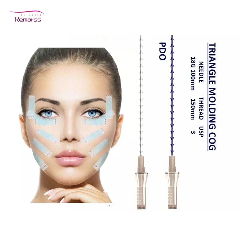 Косметическая хирургия для подтяжки кожи молдинг ПДО рыбья кость лица и тела с