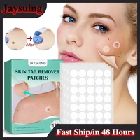 acne warts removal patch skin cleaning tags pimple treatments corn plaster acne warts invisible healing antibacterial stickers