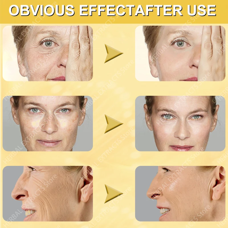 Набор для удаления морщин лица мгновенное укрепляющее лифтинговое