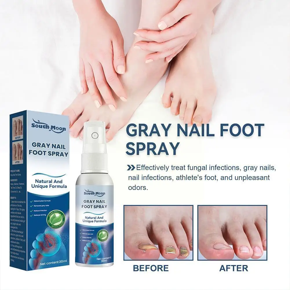 

Эффективный спрей для восстановления ногтей от грибка, 30 мл, серый спрей для утолщения ногтей, желтый Уход за ногтями, мягкие вросшие ногти для рук и ног, T8D6