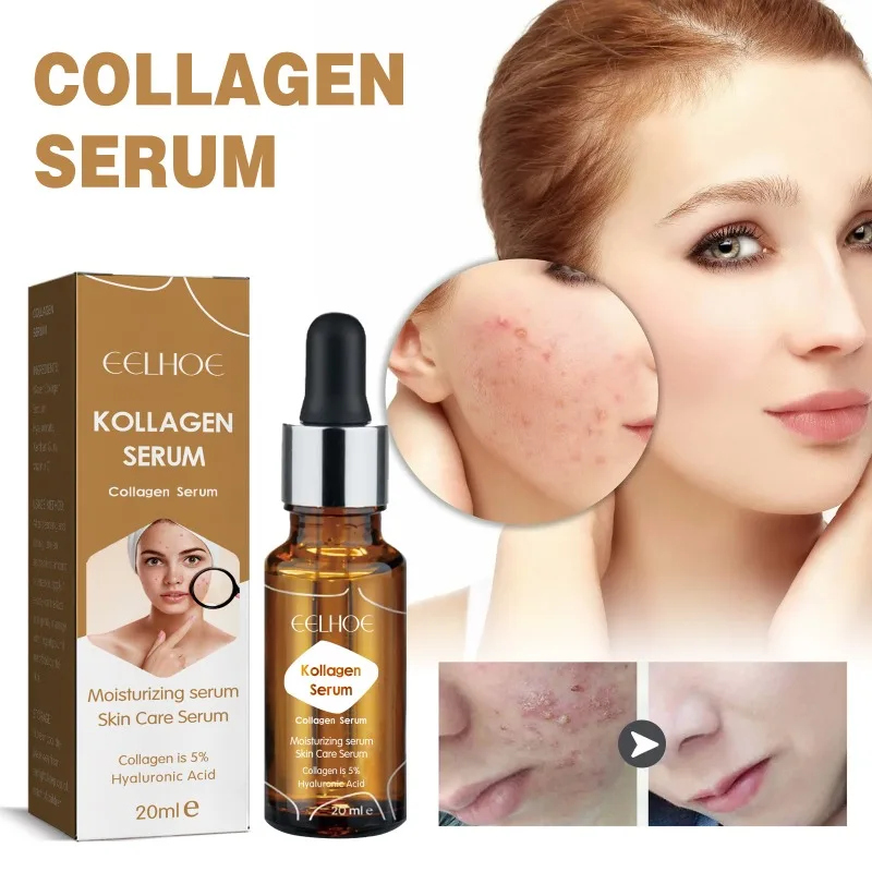 

Efficient Anti-acne Essence Moisturizing Brightening Skin Serum Pore-firming Vitamin C Essence Collagen Improve Fine Lines Serum