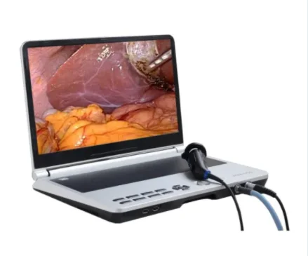

Portable Laptop Endoscopy Camera All in One Full HD Endoscope Camera System for Laparoscope, Hysteroscopes, ent with recorder