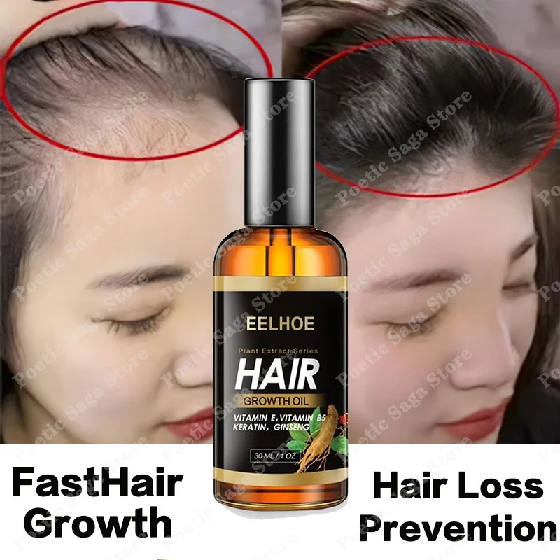 

Масло розмарина для роста волос, Имбирь против выпадения волос, искусственная эссенция для мужчин и женщин, лечение кожи головы, уход за волосами