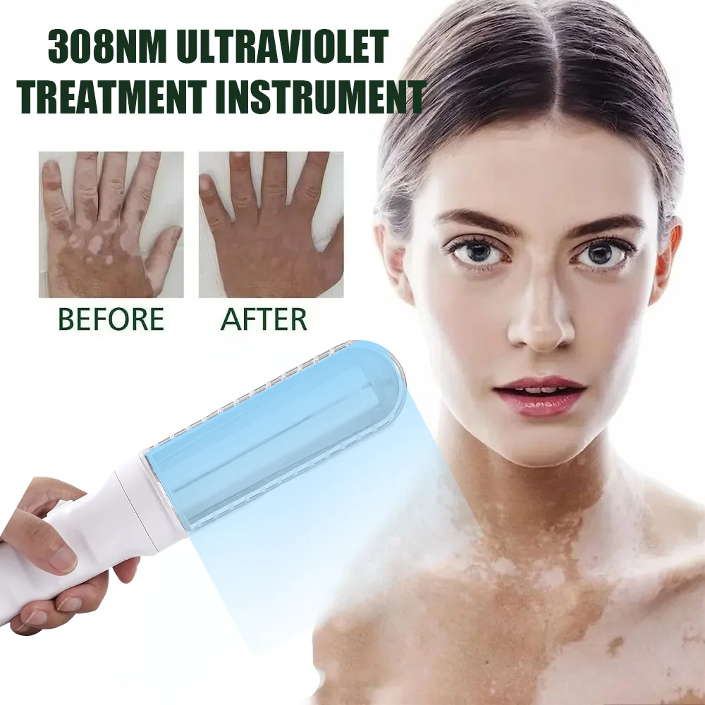 УФ-лампа оборудование для физиотерапии узкополосные лампы фототерапии