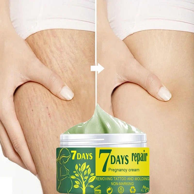 

1pcs Remove Pregnancy Scars Acne Cream Stretch Marks Treatment Maternity Repair Anti-Aging Anti Winkles Firming Body Cream
