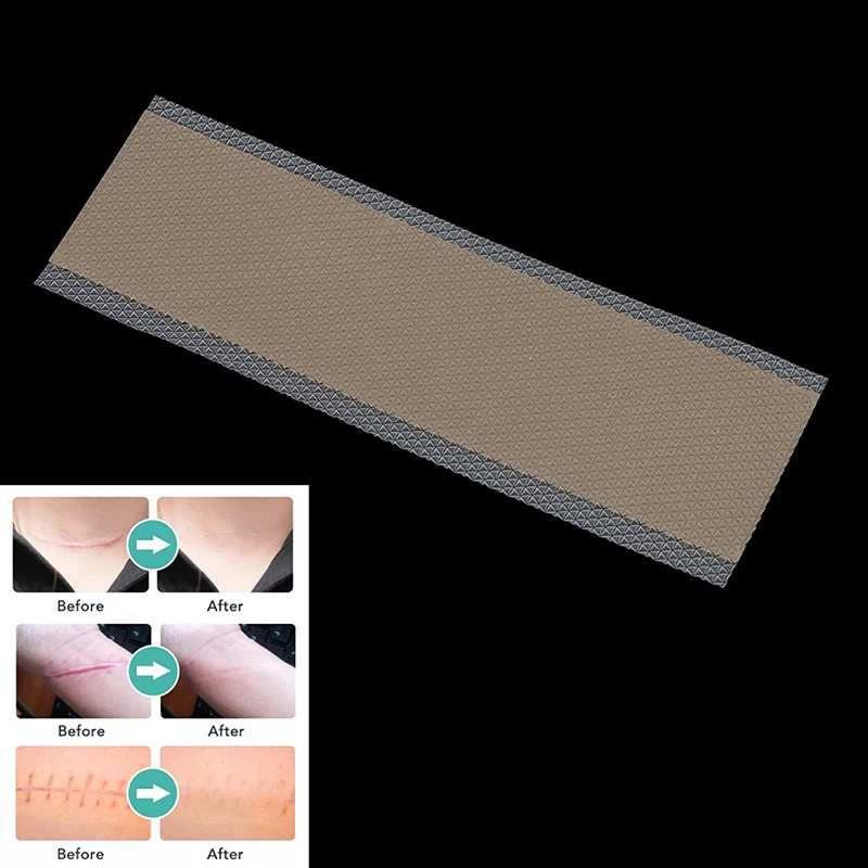 

1 шт., деталь для удаления шрамов