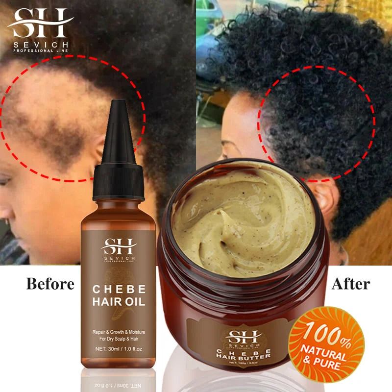 New Africa Hair Growth Essential Oil Anti Hair Loss Hair Strengthen Mask  Fast Grow Prevent Baldness Men Women Hair Care Product