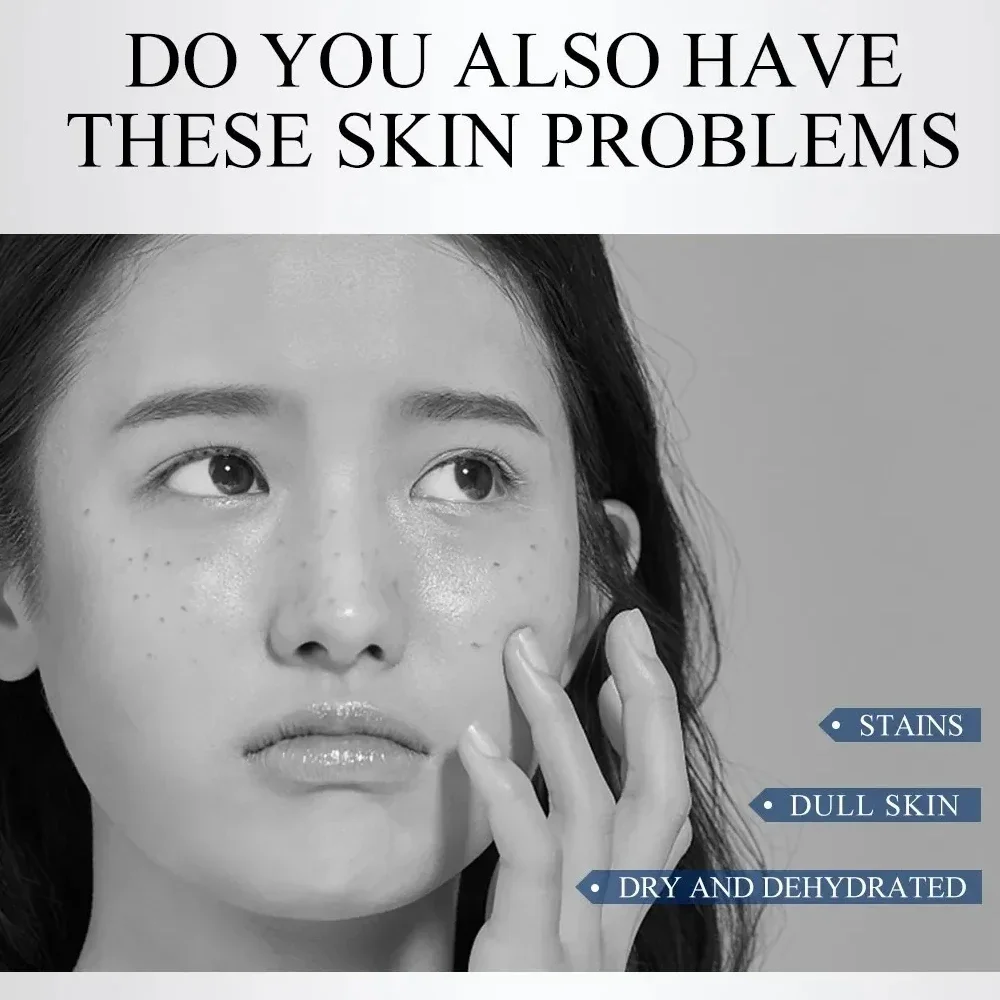 Эффективный крем для удаления хлоазмы темных пятен Melanin солнцезащитные пятна