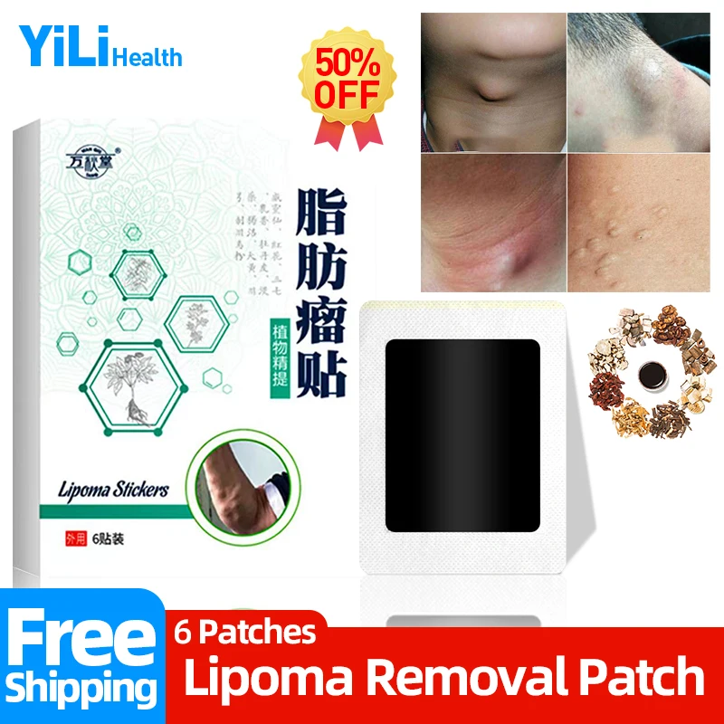 

Lipoma Remover Medical Plaster Fat Mass Herbal Patch Cellulite Treatment Cream Apply To Subcutaneous Lumps Fibroma Medicines