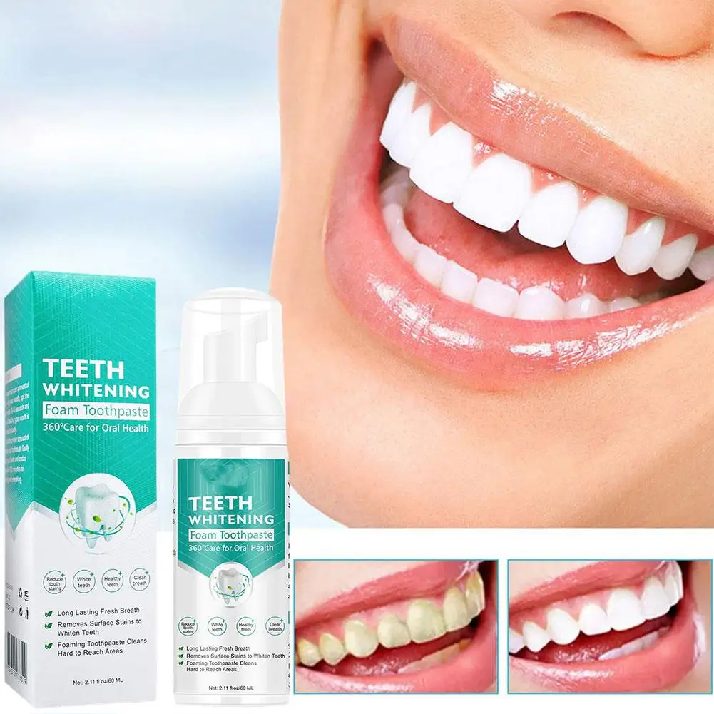 

Teeth Whitening Mousse Foam Whitening Toothpaste Ultra-fine Removal Mousse Mint Stain Deeply Oral Care Gums Cleaning Refres S7F1