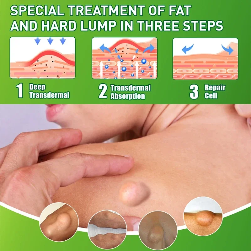 Крем Lipoma для удаления жира 20 г