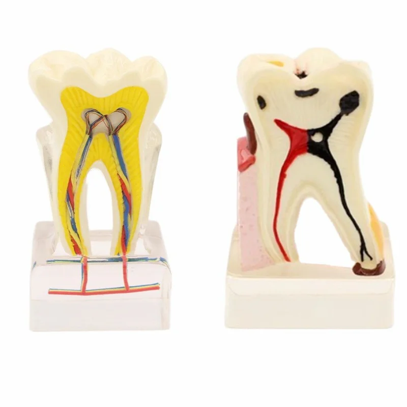 

Orthodontic model 4:1 6:1 teeth Teaching with clear base nerve anatomical dissection demonstration Dentist endodontics