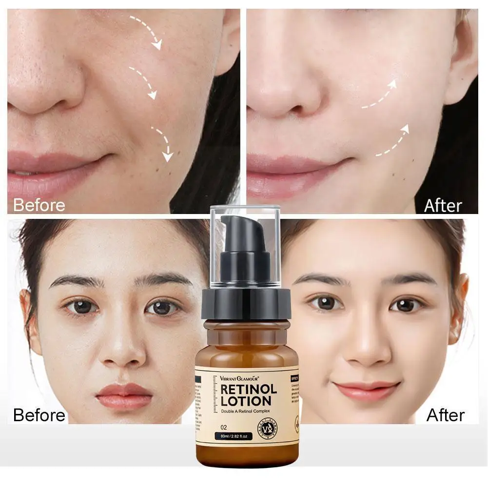 

VIBRANTGLAMOUR Retinol Face Lotion Cream Anti-Aging Care Firming Whitening Brightening Remove Moisturizing Skin Wrinkle Lif N8Q2