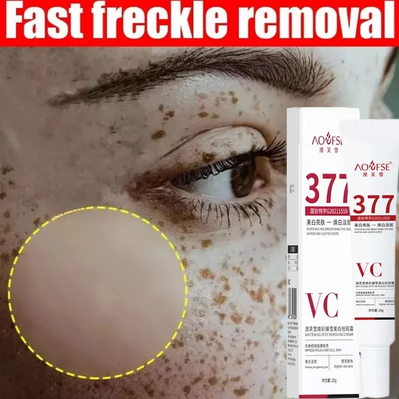 Niacinamide мелазма Осветляющий крем уменьшает меланин осветляет темную кожу хлоазма