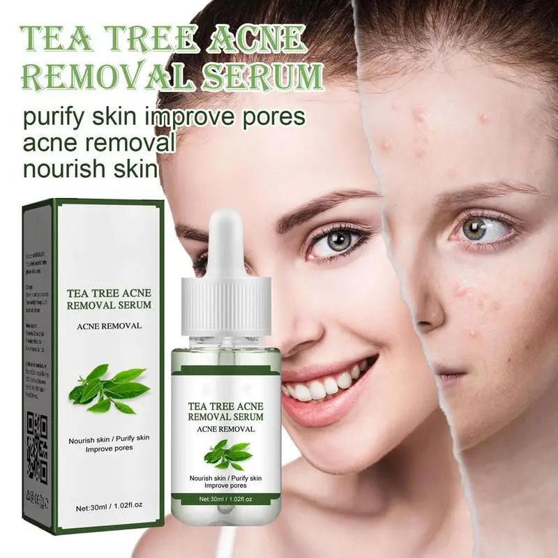 

30ml Tea Tree Face Essence Anti Acne Pore Shrinking Serums Blackhead Remover Essence Hydrating Nourishing Moisturizer Skin Care