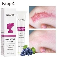 scar repair cream removal acne burn surgical scar stretch marks beauty products pigmentation corrector smoothing body skin care