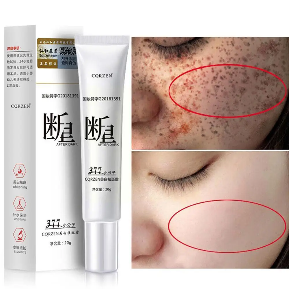 

Whitening Freckles Cream Remove Melasma Dark Spot Spots Lift Skin Firming Face Care Beauty Dark Essentials Face H1L4