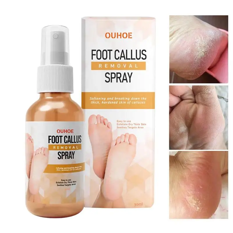 

30ml Foot Callus Remover Spray Quickly Soften Calluses Exfoliation Dry Feet Skin Hydrating Foot Dead Skin Spray Foot Care