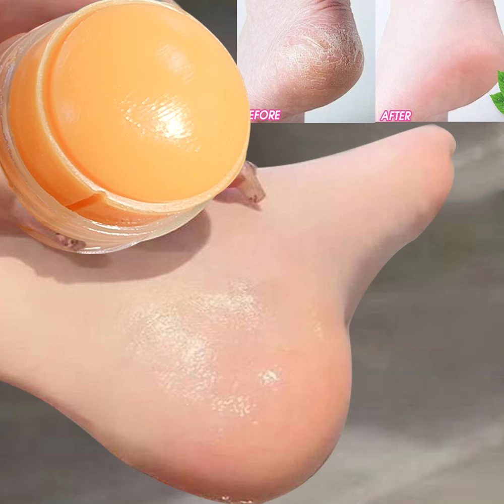 40g Urea Foot Cream Dry Cracked Feet Heel Gentle Exfoliation Softening Skin Ultra-Hydrating Hand Care Stick Protuct
