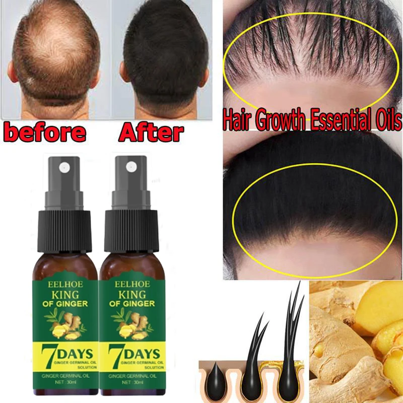 

2PCS 7 Day Ginger Hair Growth Essence Germinal Serum Essence Oil Natural Hair Loss Treatement Effective Fast Growth Hair Care