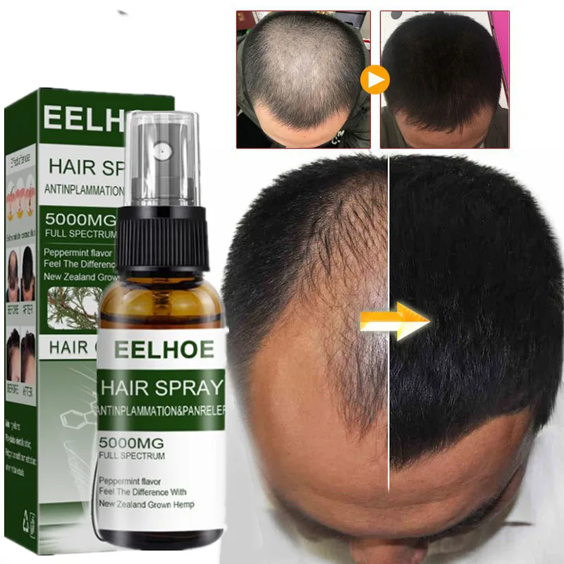 

Продукты для роста волос имбирное быстрорастущее эфирное масло для волос красота уход за волосами Предотвращение выпадения волос масло дл...