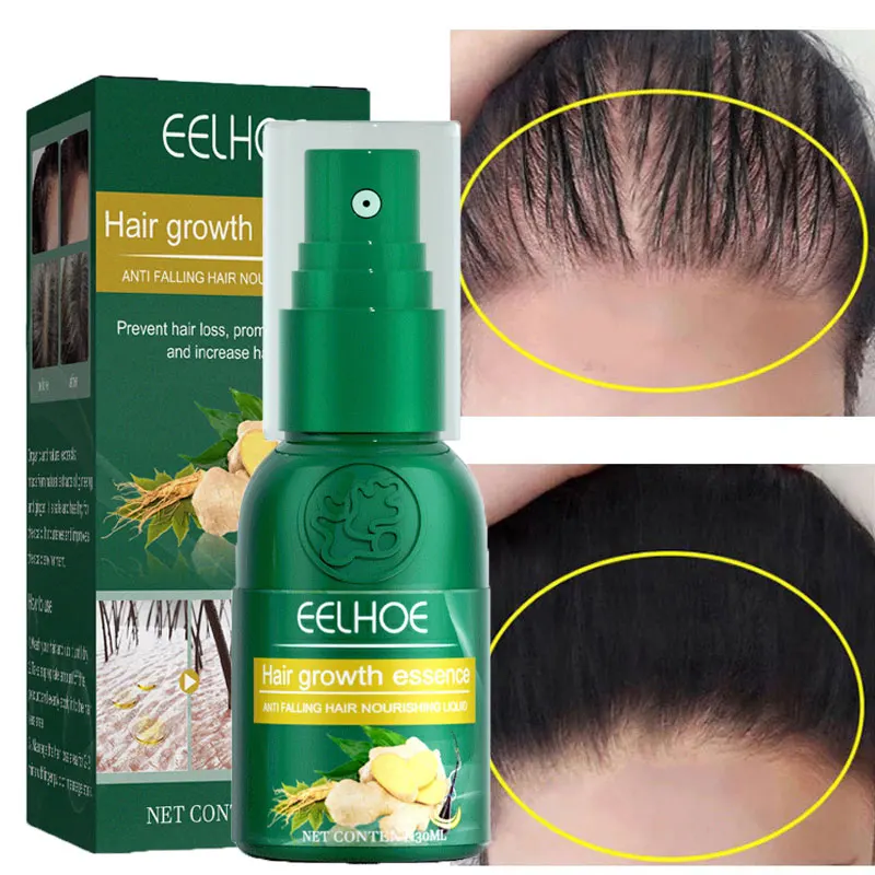 

Ginger Hair Growth Spray Serum Natural Anti Hair Loss Products Fast Growing Prevent Baldness Treatment Germinal Liquid Men Women