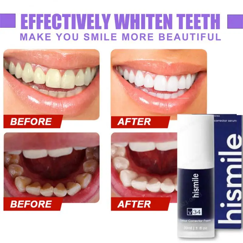 

Hismile V34 Purple Toothpaste Colour Corrector Teeth Whitening Cleaning Stain Remove Cigarette Stains Reduce Yellowing