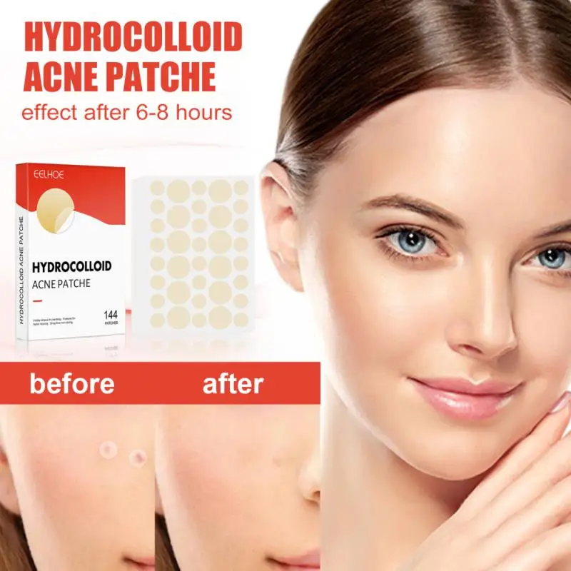

24/36/80/144 Patches Beauty Acne Tools Acne Patch Set Skin Tag Remover Pimple Master Hydrocolloid Patch Face Skin Care Tool