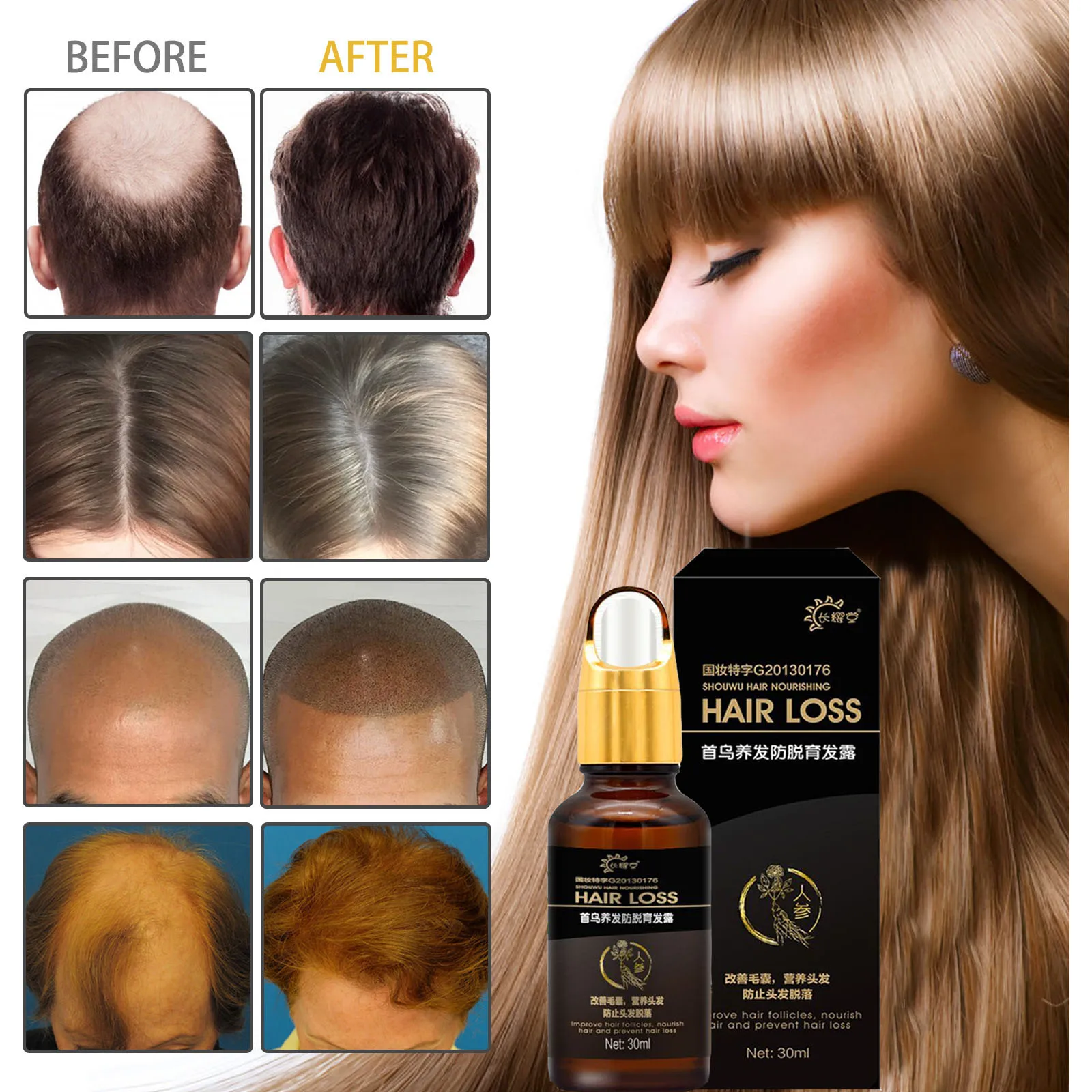 Hair Growth Products Fast Growing Oil Loss Care Liquid Beauty &amp Scalp Treatment Dense Serum |
