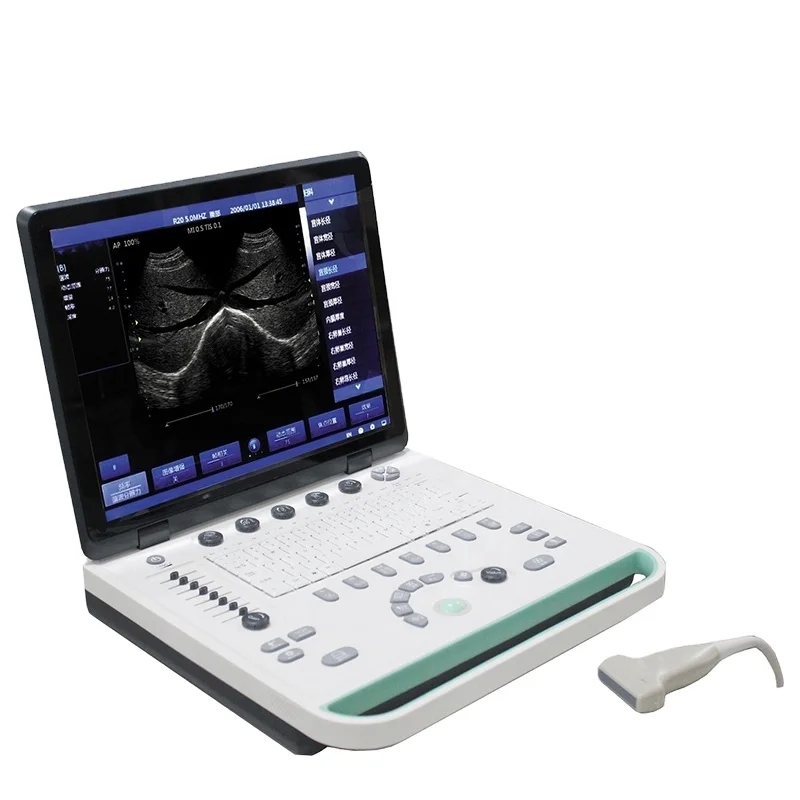 

IN-A032-2 ICEN 3d ICEN Portable Digital laptop Ultrasound scanner machine