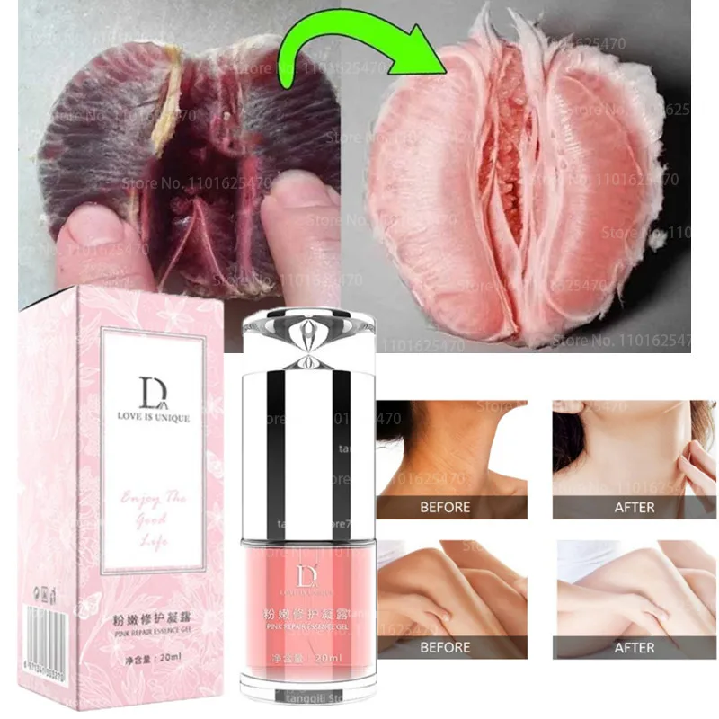 

Частные детали, розовый тендер для удаления меланина, женский тендер, красный пигмент, частный сосок, ареола, вагинальное средство для ухода...