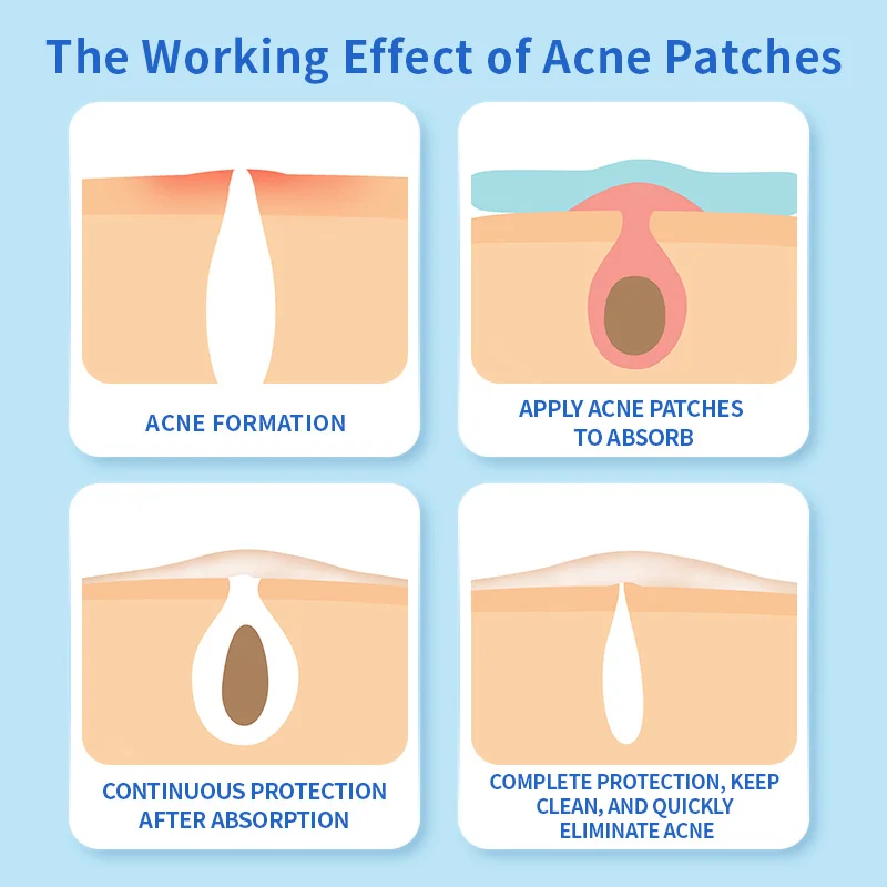 48/120 шт. пластырь от прыщей невидимый дышащий ультратонкий чехол антисвез ремонт