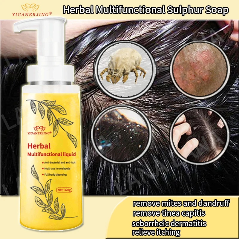 320g Yiganerjing Seborrheic Dermatitis Removal Scalp Ringworm Anti-itch and Oil Control Removal Mite Shampoo Hair Care Products