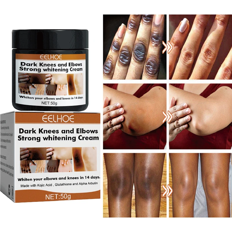 Pigmentation Correctors For Black Skin Hand Knuckle Elbows K