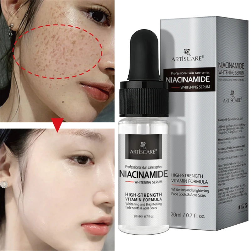 

Whitening Serum Remove Dark Spots Freckle Essence Anti-Aging Niacinamide Fade Pigmentation Melasma Brighten Skin Care Beauty