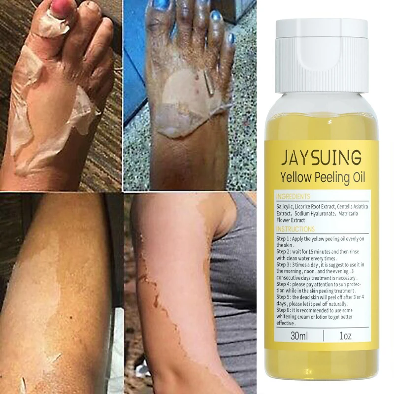 

30ml Body Exfoliation Yellow Peeling Oil Bleaching Dark Skin Remove Arm Knee Legs Melanin Brightening Whitening Beauty Skin Care