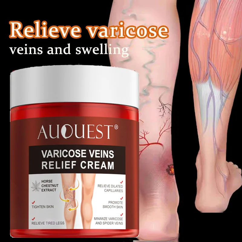 

Varicose Veins Treatment Cream Relieve Leg Tired Vasculitis Phlebitis Spider Pain Ointment Plaster Muscle Swelling Elimination