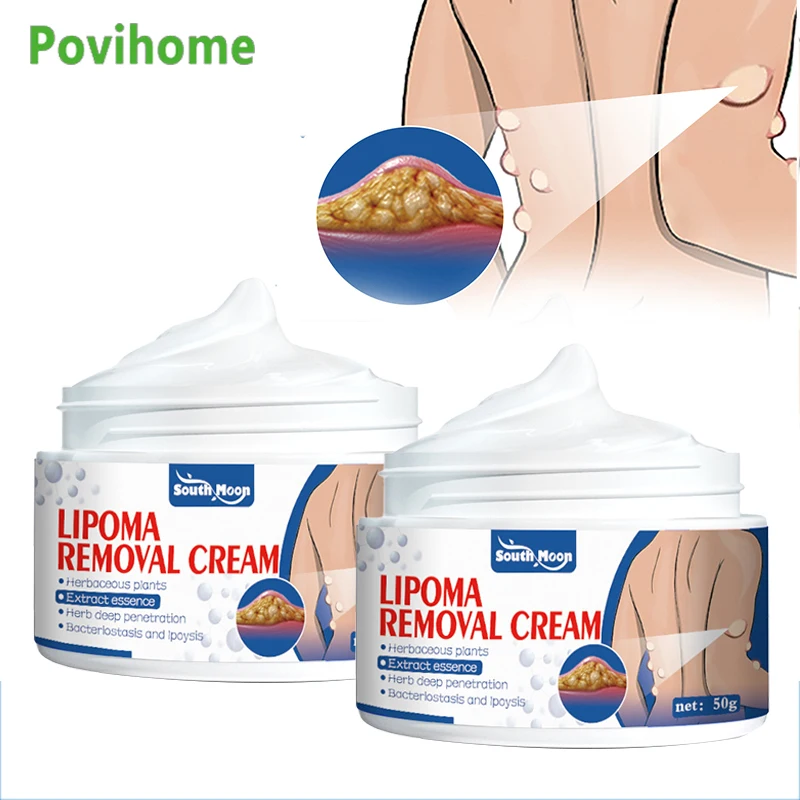

Крем Lipoma 50 г для снятия боли, лечение отеков кожи, липолиза, целлюлита, жира, удаление кусочков, мазь против опухолей