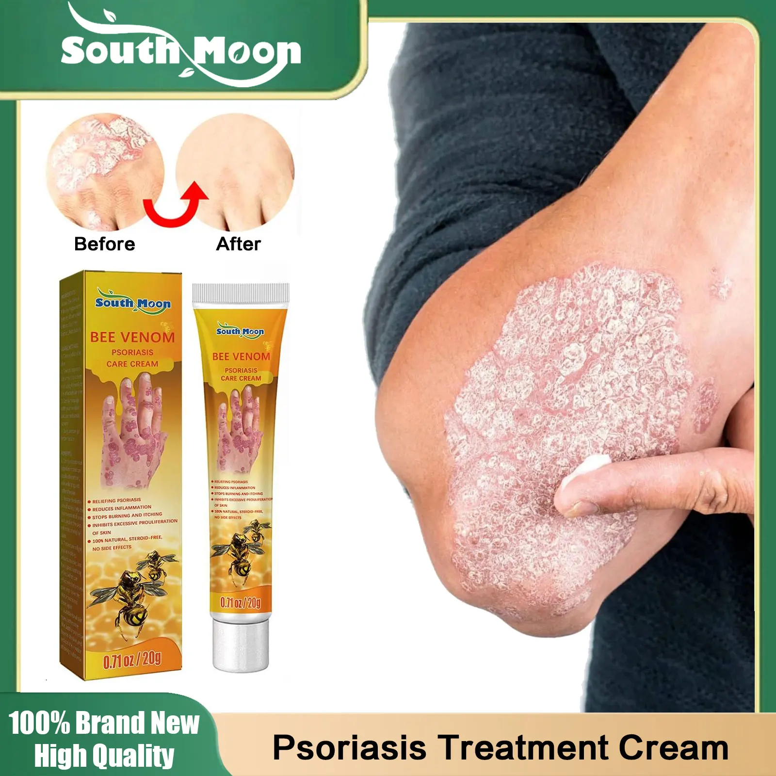 

Psoriasis Treatment Cream Antibacterial Rash Urticaria Desquamation Relief Inhibit Dermatitis Fungus Herbal Anti Itch Ointment