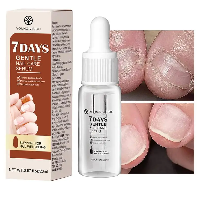 

Toenail Cleaner Liquid Grey Nail Repair Essence 20ml Toe Nail Strengthener Purpose Nail Repair Essence Effectively Stops Damage