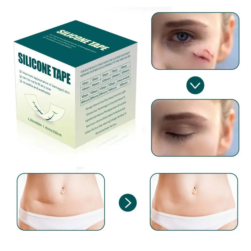 Силиконовые листы для шрамов силиконовые полоски многоразовые удаления
