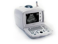 medical portable digital b ultrasonic diagnostic machine