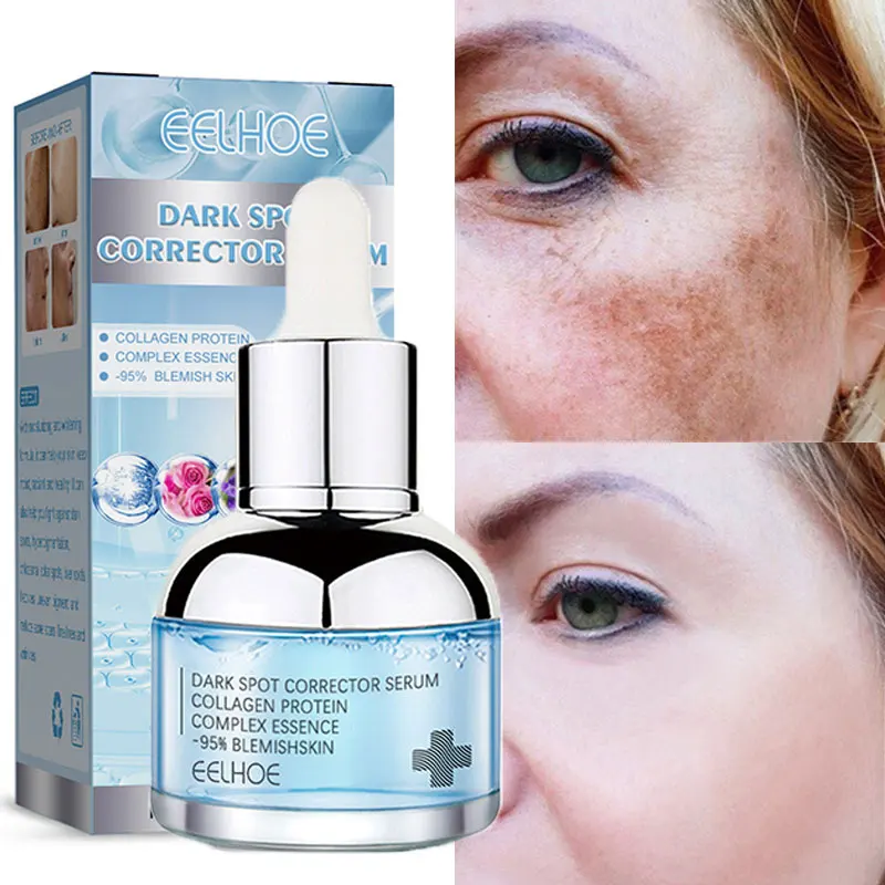 

Dark Spots Remover Face Serum Collagen Essence Protein Anti Aging Freckles Whitening Skin Brighten Melanin Pigmentation Melasma